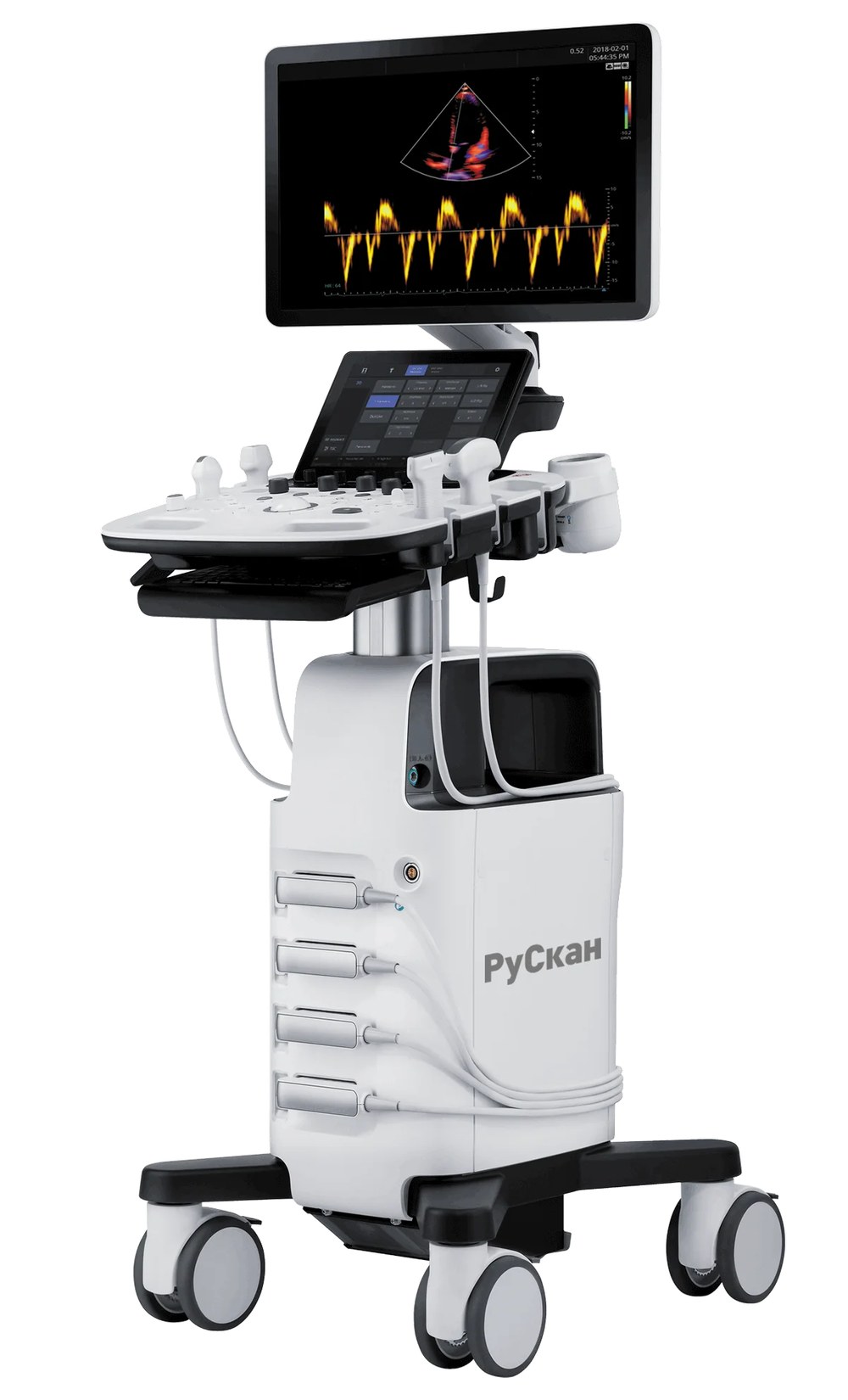 УЗИ-аппарат РуСкан 60 — Kenig Medical