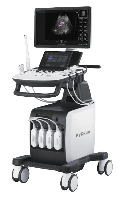 УЗИ-аппарат РуСкан 65 — Kenig Medical