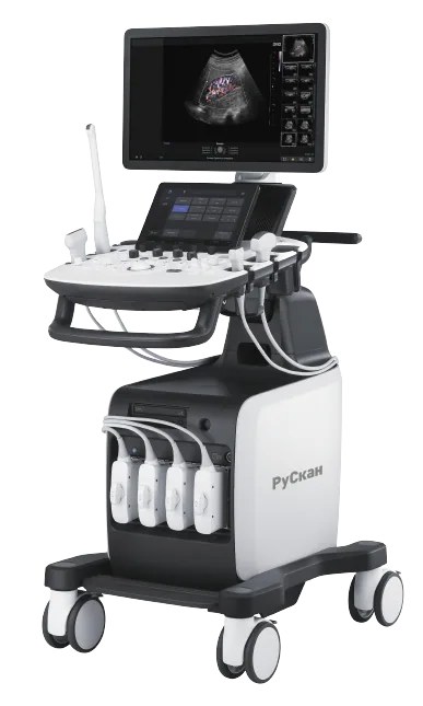УЗИ-аппарат РуСкан 65М — Kenig Medical