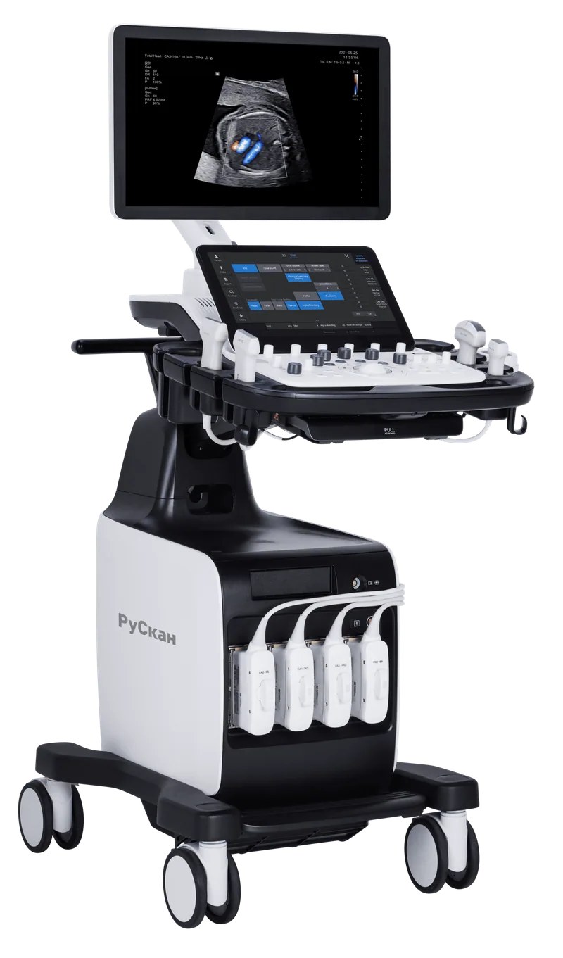 УЗИ-аппарат РуСкан 75М — Kenig Medical